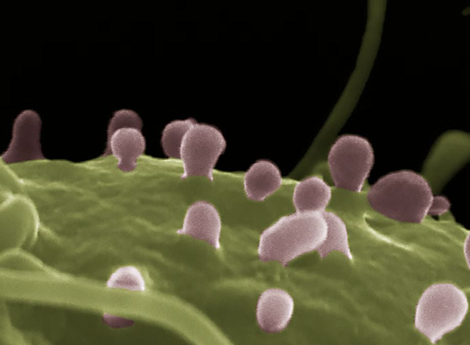 Call for Papers Extracellular Vesicles During Development and Disease